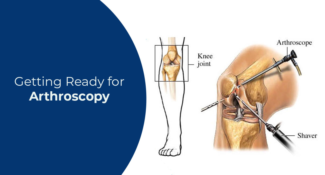 Getting Ready for Arthroscopy